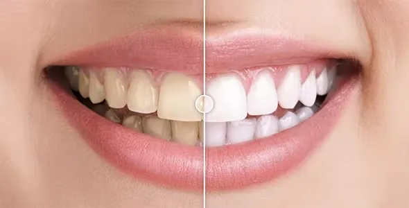Before and After Images Comparison Plugin